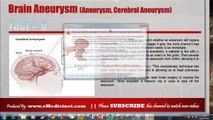 Information about Brain Aneurysm