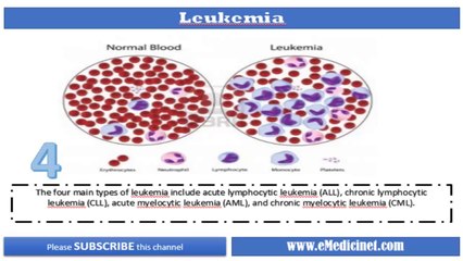 Leukemia - Blood Cancer