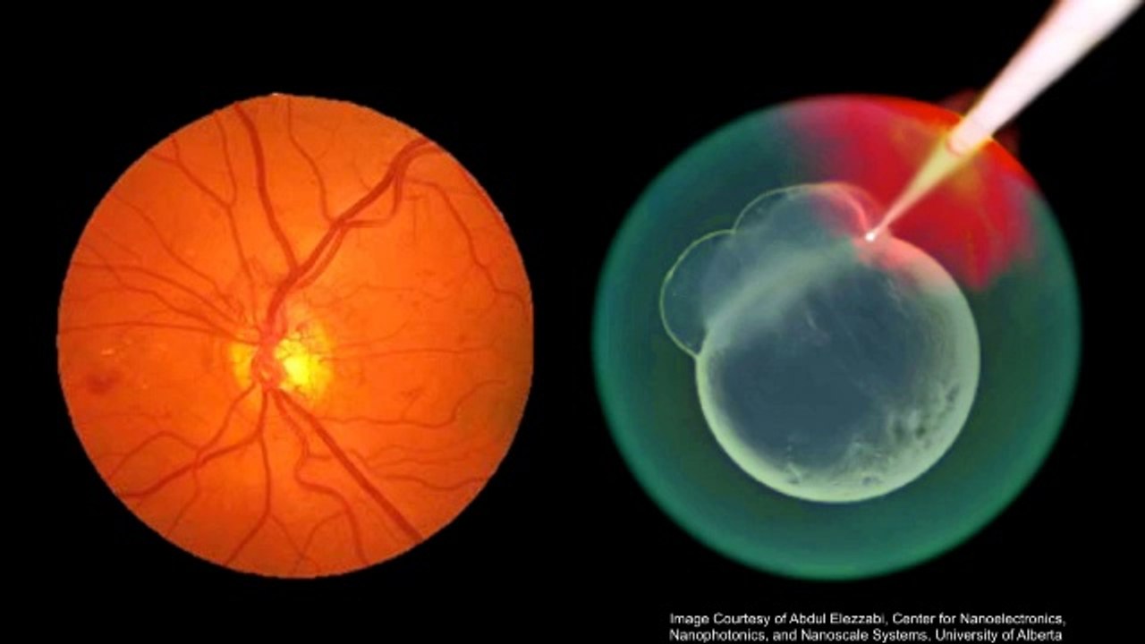 Catherine Mohr: How Nanotechnology Kills Cancer Cells