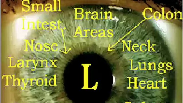 Gözden Teşhis Eğitim