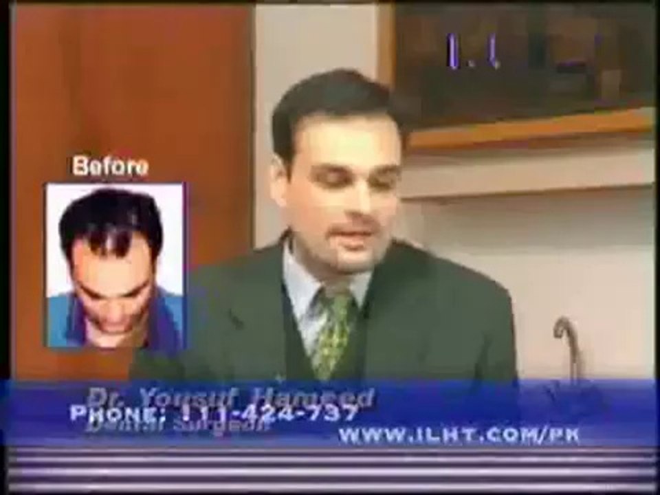 Hair Transplant Surgery Results at ILHT Pakistan