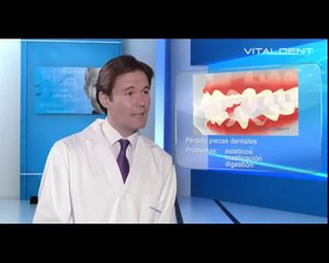 Vitaldent Parquesol: Saneamiento Dental Encías