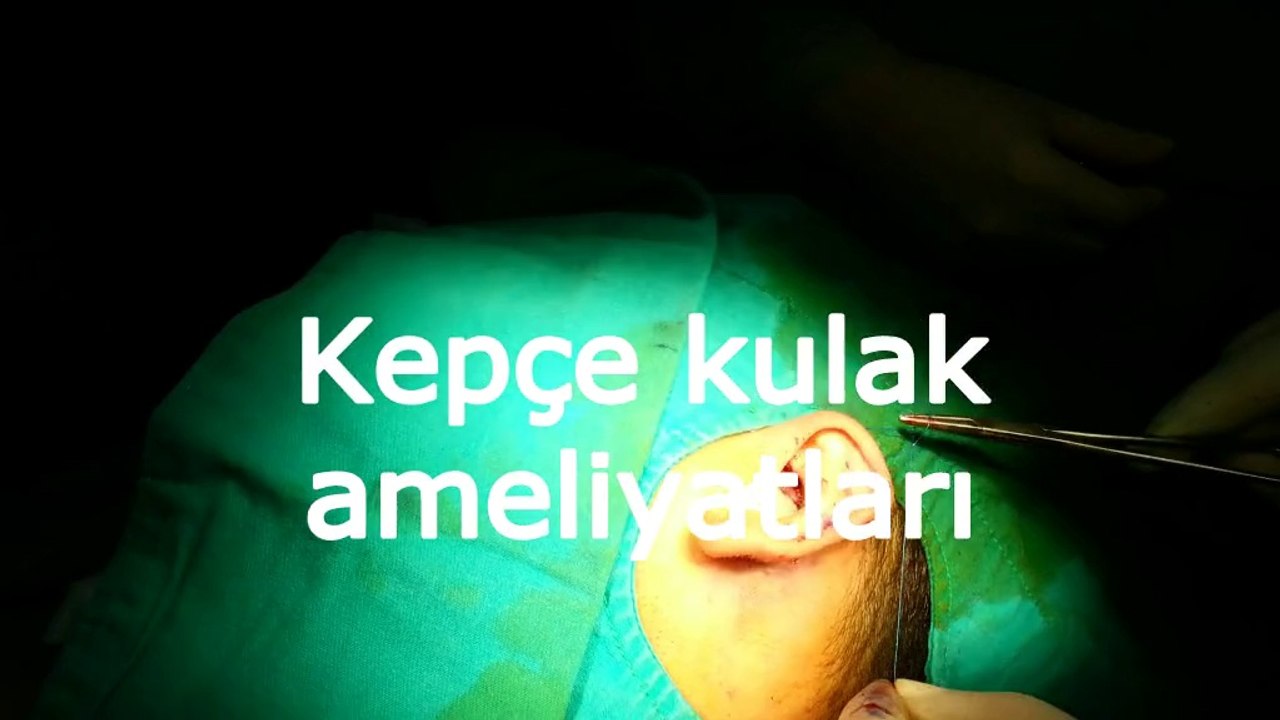 kepce-kulak-ameliyati-antalya-izle