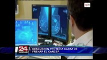 Investigadores hallan una proteína capaz de frenar el cáncer de mama