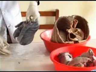 Lungs- Gross Anatomy