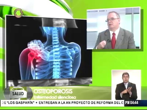Osteoporosis produce 9 fracturas de caderas al día