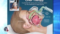How a CPAP Device Compares to an Oral Appliance to Treat Sleep Apnea, With Dr. Rich Gillespie, Vancouver, Washington