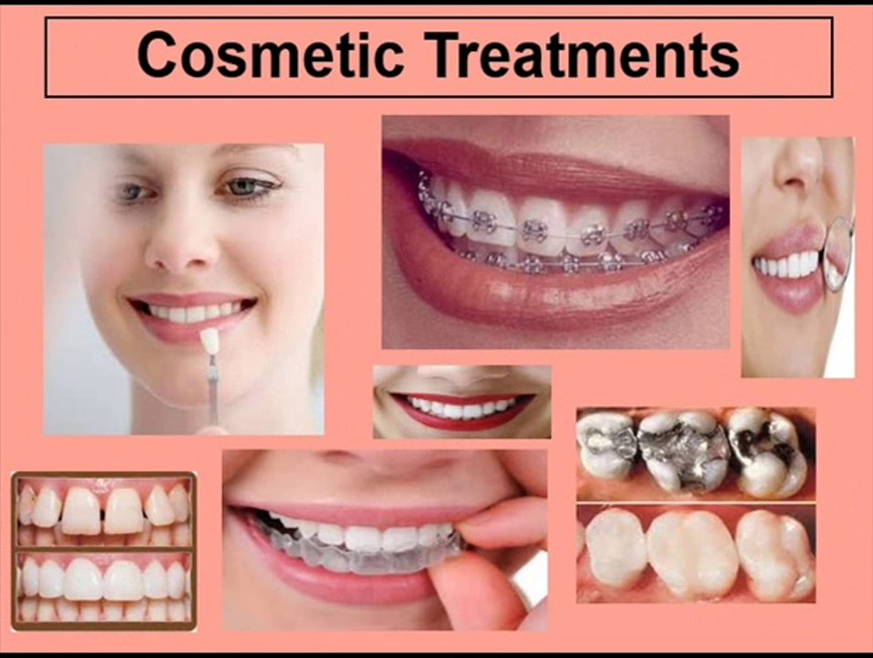 Cosmetic Dentist And Cosmetic Treatments