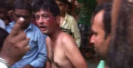 Tecavüzcüyü Yakalayan Vatandaşlar Cinsel Organını Kesti