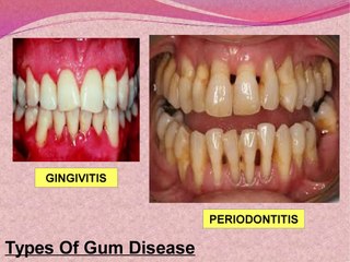 Best Dental Care Information And Tips