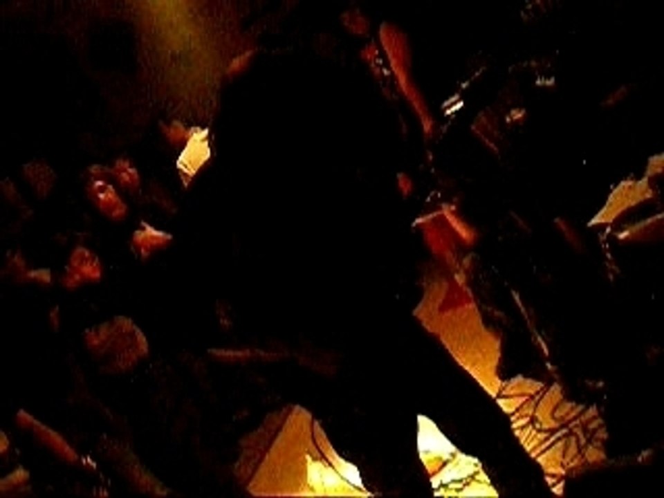 Anal kezak _ emoroide live