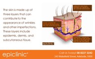 What Causes Wrinkles and What Can I do to reduce them?