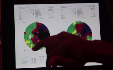 Great Result- Medical Test Result of Edmond- Stargardt's Disease Treatment