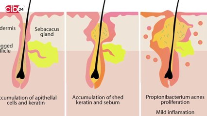 Spiritual Medicine - Skin Care Tips