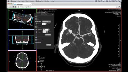1. AppniqMD_MIP-MPR-Web