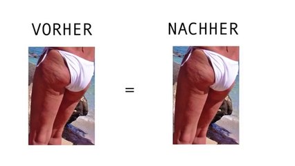 Was ist Cellulite? Ursachen & Tipps ✨