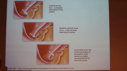 Pediatric Radiology Case - David Samocha - Tuesday 28th January 2014