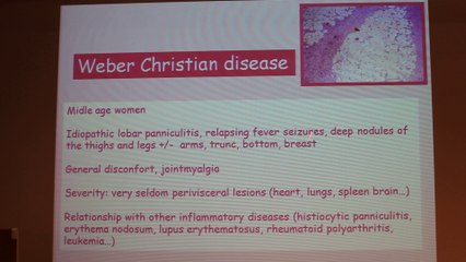 Cervical And Facial Bumps MRI Approach - Françoise Héran - Wednesday 29th January - Part 3