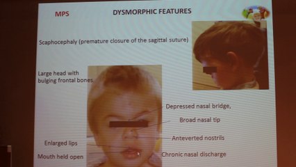 Comparative Adult And Child MRI Cases - Françoise Héran & Nathalie Boddaert - Wednesday 29th January