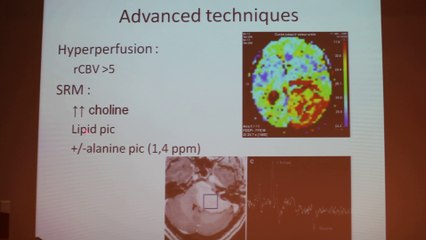 Extra Axial Lesions - Françoise Héran - Wednesday 29th January - Part 1