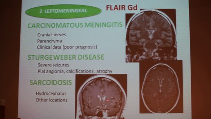 Extra Axial Lesions - Françoise Héran - Wednesday 29th January - Part 2