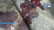 شاهد|| إصابة طالب أزهري عقب إطلاق أنصار الإخوان الألعاب النارية عليه