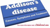 Addison's Disease - Causes, Diagnosis, Symptoms and Treatment