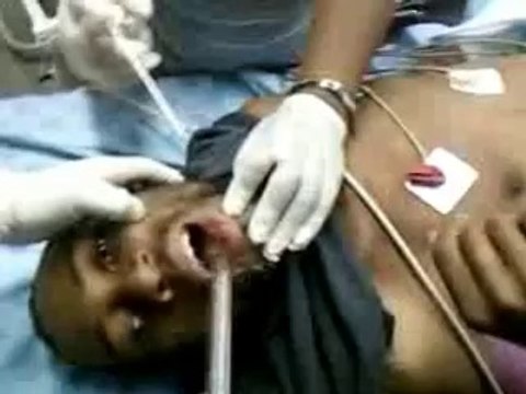 Un homme avec un téléphone dans la bouche