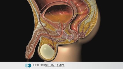 What is Urethritis? by Urologist in Tampa