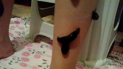 SÜLÜK  TEDAVİSİ   "Çise'ni'n ayak ağrıları için"