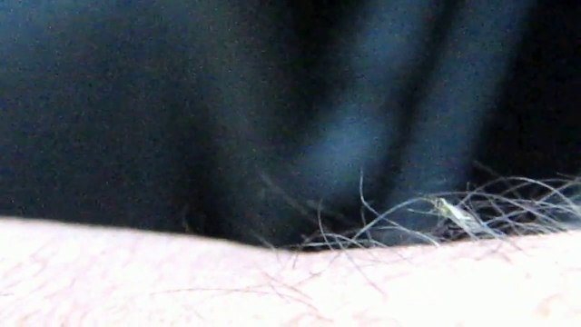 Eerie Blood sucking Insect On My Skin-Blood Curdling Video