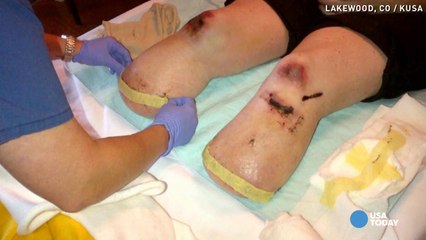 Mom recounts being trapped in wrecked car for 6 days