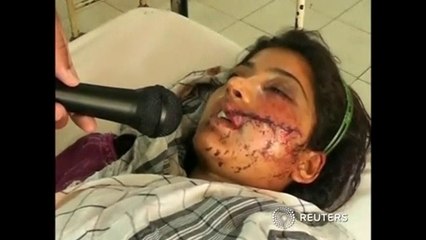Pakistani woman survives attempted honor killing