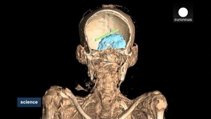 TAC: Los secretos de las momias