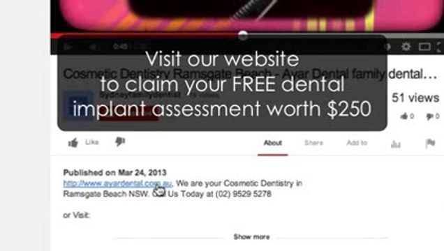 Dental implants Ramsgate - Dental implants in Ramsgate