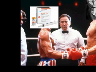 Dynosumab vs Tumeur osseuse à cellules géantes