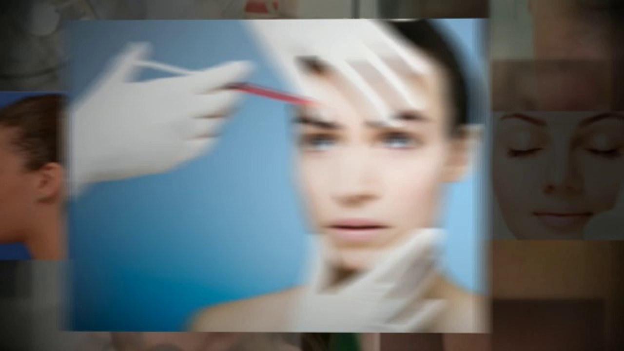 Facelift Beverly Hills