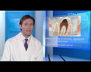 Saneamiento dental Integral Vitaldent Santiago