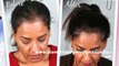 balding - baldness - female hair loss - Hari Transplant Chennai - Dr. Ari Chennai - Dr. Ari Arumugam