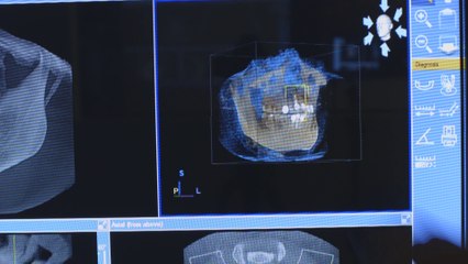 3D Cone Beam – The Future Of Diagnostics In Pasadena, TX (281) 991-1905