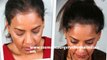 hair loss shampoo - hair loss treatment - hair loss women - Dr. Ari Chennai - Dr. Ari Arumugam - Plastic Surgery Chennai