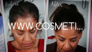 hair spa - hair thinning - hair transplant - Dr. Ari Arumugam - Cosmetic Surgery Chennai - Dr. Ari Chennai