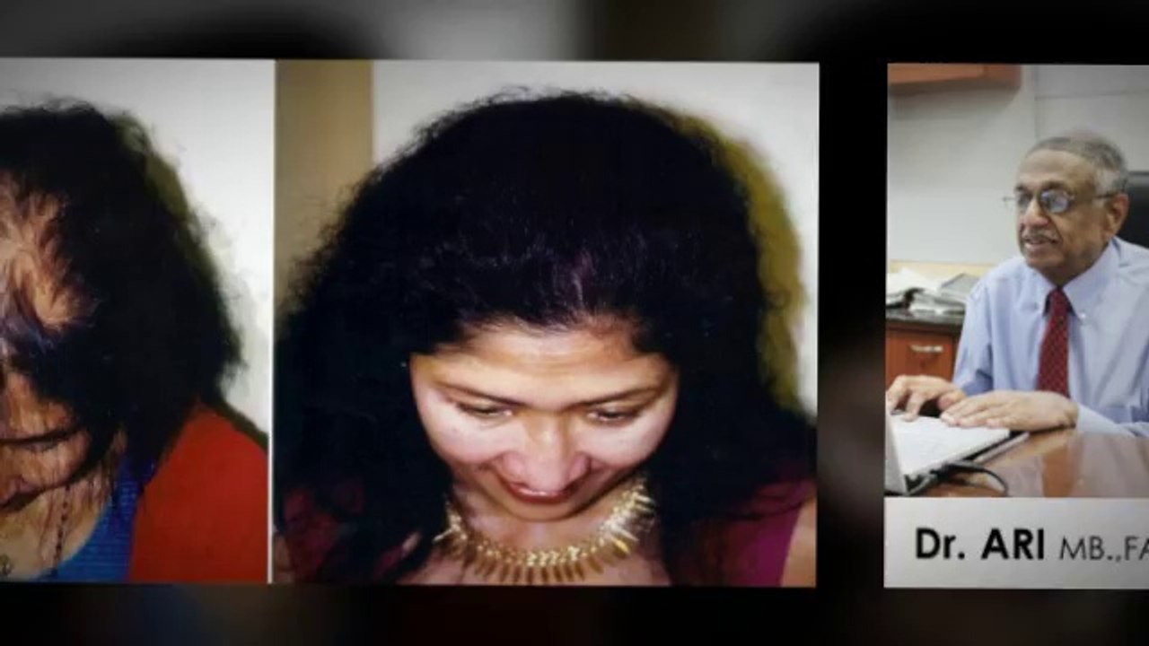 hair growth shampoo - hair implants - hair loss - Dr. Ari Arumugam - hair Loss Treatment Chennai - Dr. Ari Chennai