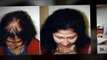 hair restoration - hair spa - hair thinning - Dr. Ari Arumugam - Plastic Surgery Chennai - Dr. Ari Chennai