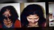 hair spa - hair thinning - hair transplant - Dr. Ari Arumugam - hair Loss Treatment Chennai - Dr. Ari Chennai