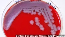 Up To 75 CDC Workers Accidentally Exposed To Anthrax