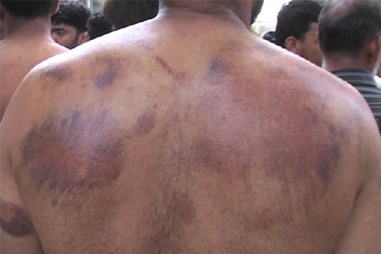 Dunya News - Doctors examine 21 arrested PAT workers on court orders