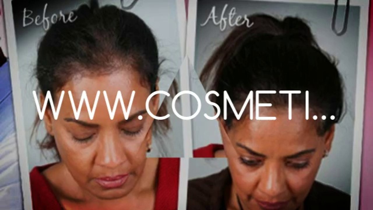 hair growth products - hair growth shampoo - hair implants - Dr. Ari Arumugam - hair Transplant Chennai - Dr. Ari Chennai