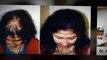 how to stop hair loss - laser comb - male pattern baldness - Dr. Ari Arumugam - hair Loss Treatment Chennai - Dr. Ari Chennai