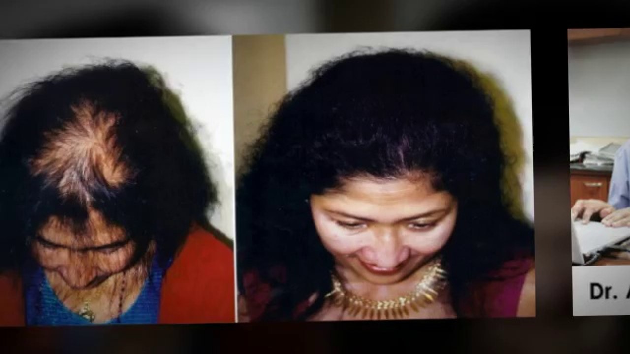 laser comb - male pattern baldness - natural hair growth - Dr. Ari Arumugam - hair Transplant Chennai - Dr. Ari Chennai